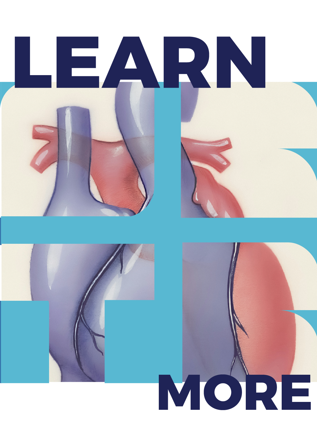 Heart Transplantation Infographic